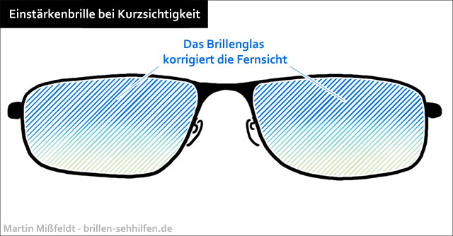 Einstärkenbrille gegen Kurzsichtigkeit