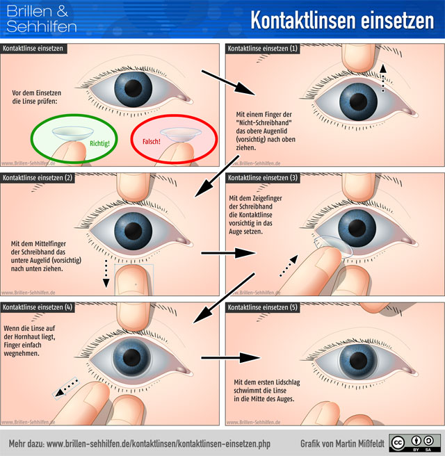 Kontaktlinsen einsetzen - Infografik